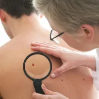 Lockdowns Linked to Skin Cancer Delays Costing &euro;7bn in Europe