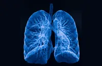 Socioeconomic Impact on Lung Cancer Mortality 