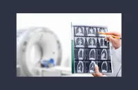 Impact of Emphysema on AI Performance in Lung Nodule Detection