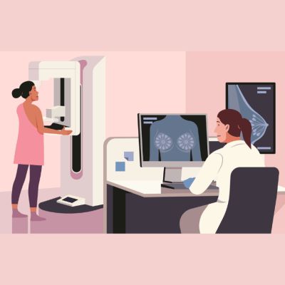 Screening Mammography and Breast Cancer: Debunking Misconceptions and Highlighting Benefits