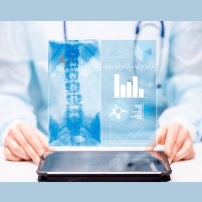 Using ChatGPT to Structure Data from Mechanical Thrombectomy Radiology Reports