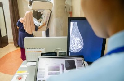 USPSTF Breast Cancer Screening Recommendations Shifts Towards Earlier Screening