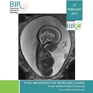 Fetal MRI Interactive Workshop 2017