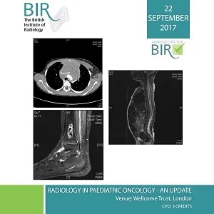 Radiology in Paediatric Oncology &ndash; an Update