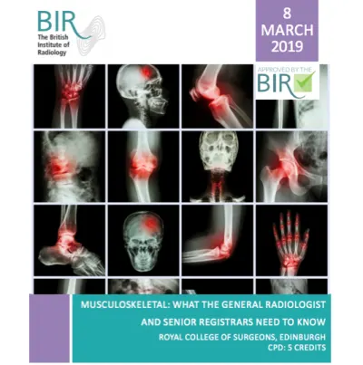 Musculoskeletal: What the general radiologist and senior registrars need to know 