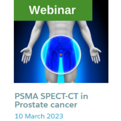 PSMA SPECT-CT in Prostate cancer