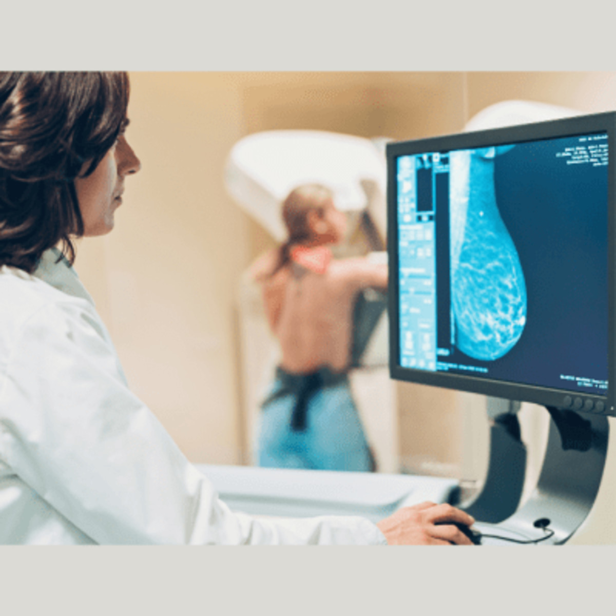 AsymMirai: New Mammography-based Deep Learning Model for Breast Cancer Risk Prediction