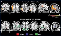 Axial and sagittal MR images 