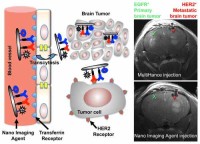 Noninvasive MRI diagnostic method