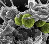 Hospital-associated MRSA bacteria