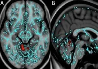 Vermis, the brain&#039;s region responsible for fear conditioning