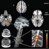 Neural correlates of motor sequence learning