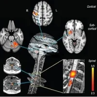 Neural correlates of motor sequence learning