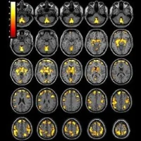 T1-weighted MR imaging exam of the brain