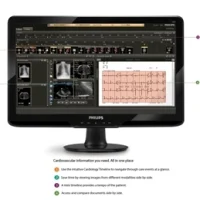 Philips new integrated Cardiology Solutions