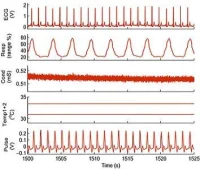 signals recorded during anaesthesia