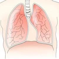 Graphic of lungs and diaphragm, credit Pixabay