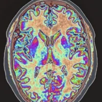 Colourised magnetic resonance image of the human brain