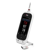 Masimo Announces Limited Market Release of Rad-67&trade; rainbow&reg; Pulse CO-Oximeter&reg; with Next Generation SpHb&reg;