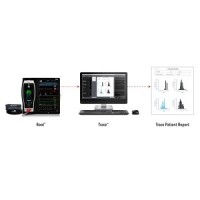 Masimo Announces U.S. Release of Trace&trade; Data Visualization and Reporting Tool