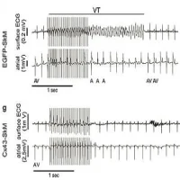 Burst stimulation induces self-terminating VT in a representative EGFP-SkM transplanted mouse in vivo.