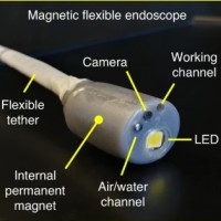 Technology Can Make Endoscopy Safer