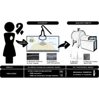 New Tool May Help Predict Breast Implant Rupture Risk