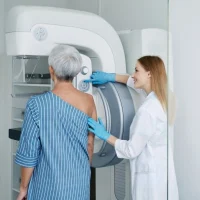 Breast Cancer Screening Recommendations: Insights from the CISNET Model