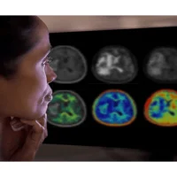 Philips &amp; Synthetic MR: Advancing Neurology Care with AI Brain Imaging at #ECR2024