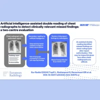 Enhancing Chest Radiograph Interpretation: Pioneering Study on AI-Assisted Double Reading Workflow