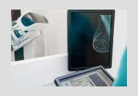 AI in Mammography: Earlier Detection and Decreased Radiologist Burnout
