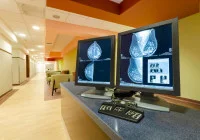 Optimising Mammography Screening with AI