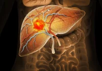 Advancing Hepatocellular Carcinoma Imaging