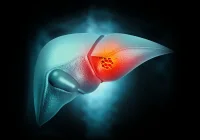 Preoperative Prediction of Microvascular Invasion in Hepatocellular Carcinoma