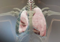 Enhancing Pneumothorax Detection with AI in Chest X-rays&nbsp;