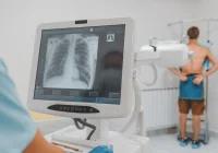 Enhancing Lung Nodule Detection with AI