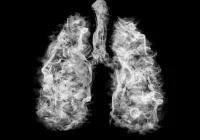 Long-term Airway Recovery After Smoking Cessation: A CT-Based Analysis