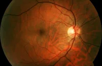 Retinal Vascular Fingerprint to Predict Stroke Risk 