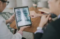 DL for Osteoporosis Detection Using Chest CT Scans