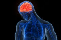 Predicting Haemorrhagic Transformation of AIS with AI Models