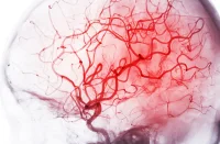 Ultra-low-dose Coronary CT with Deep Learning Reconstruction