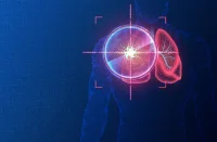 The Role of AI and Machine Learning in Precision Oncology