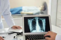 Advancing Global Low-Dose CT Screening for Lung Cancer