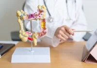 MRI Radiomics for Lymphovascular Invasion Prediction in Rectal Cancer