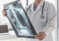 Doctor analysing chest X-ray for accurate medical diagnosis and patient care
