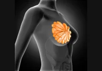 Medical Concept of Chest Pain &ndash; Woman with Highlighted Upper Body Area