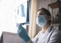 Doctor Examining Lung X-ray &ndash; Early Detection and Diagnosis of Respiratory Conditions 