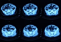 CT scan images of abdominal cross-sections &ndash; diagnostic imaging for internal organ analysis and medical evaluation.