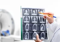 Doctor reviews lung CT scan images with chest tomography machine in background