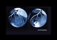 Cross-sectional coronary CT angiography scans showing detailed views of heart vessels, aiding in the non-invasive diagnosis of coronary artery disease and cardiac assessment.&nbsp;